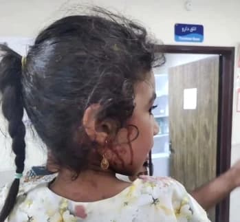 Un attacco statunitense contro un’abitazione a Sirik, dove era in corso un matrimonio, ha causato la morte e il ferimento di quasi cinquanta persone, tra cui un bambino rimasto ucciso.
